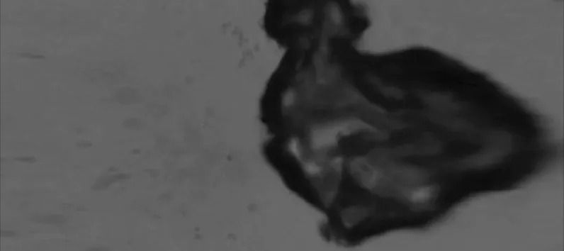 Collapsing cavitation bubble inside a collagen hydrogel